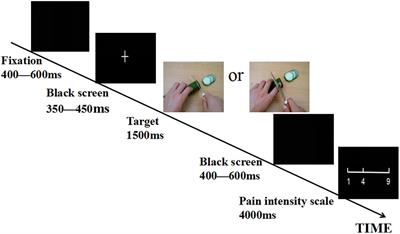 The Role of Social Power in Neural Responses to Others’ Pain